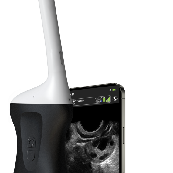 Product-EC7-Endocavity-Handheld-Portable-Wireless-Ultrasound-Scanner
