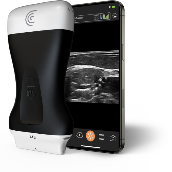 Product-L15-High-Freq-Linear-Handheld-Portable-Wireless-Ultrasound-Scanner