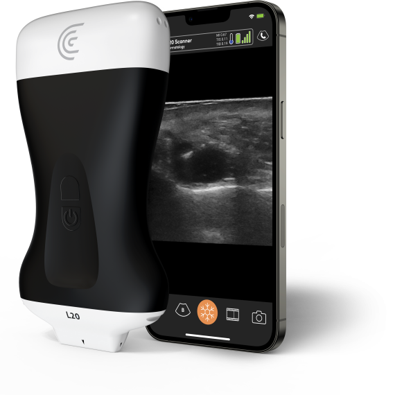 Product-L20-Ultra-High-Freq-Linear-Handheld-Portable-Wireless-Ultrasound-Scanner
