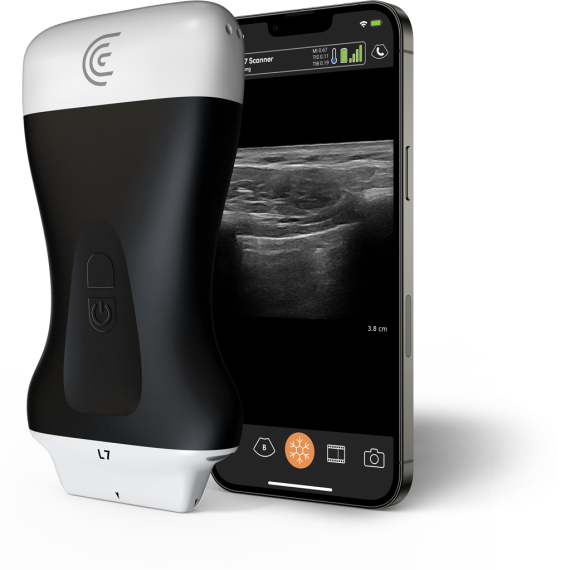 Product-L7-Linear-Handheld-Portable-Wireless-Ultrasound-Scanner